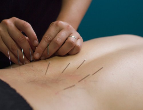 Dry Needling Is The Next Big Thing In Physical Therapy